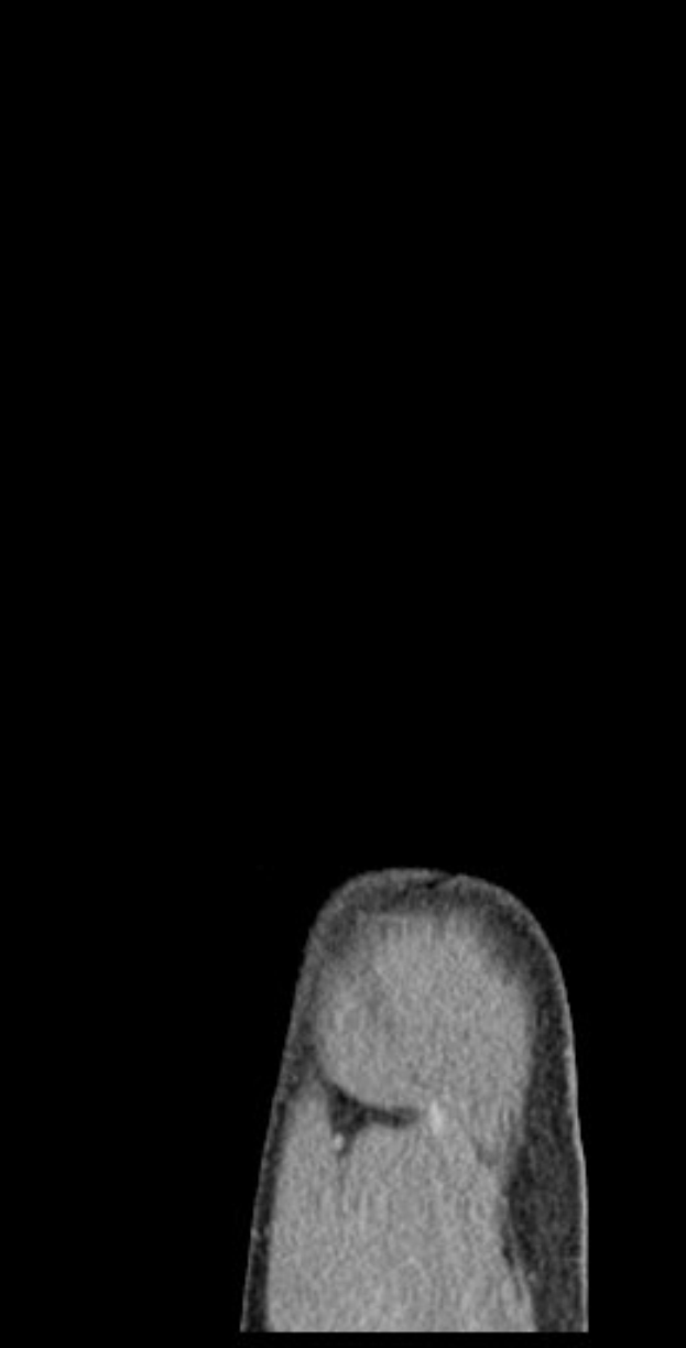 Schwarze und weiße MRI-Aufnahme eines Mannes, die detaillierte Hirnstruktur zeigt.