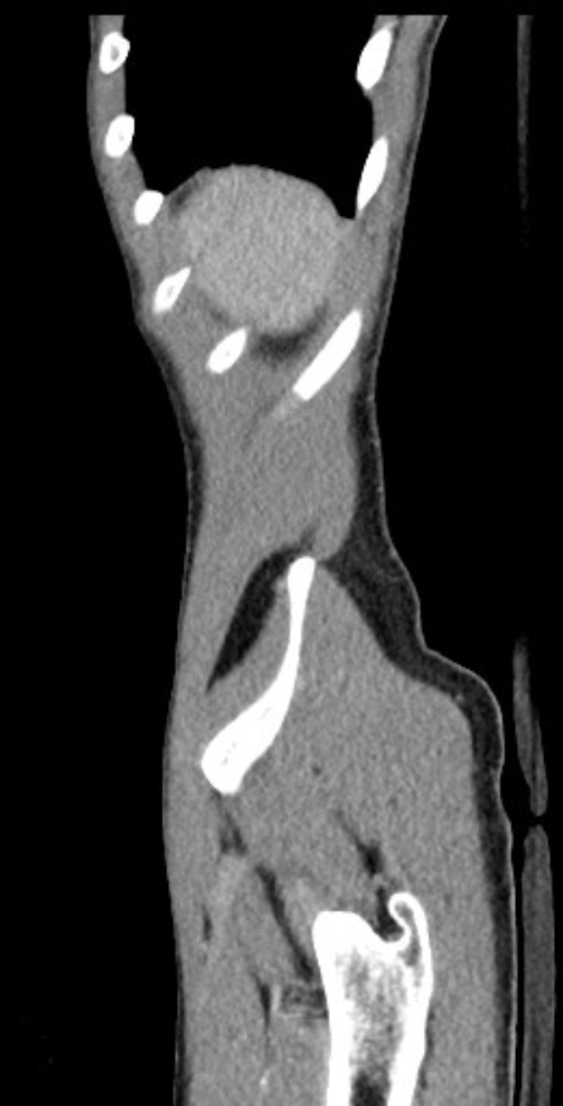 Schwarzer und weißer MRI-Scan eines Kniegelenks, der detaillierte Anatomie zeigt.
