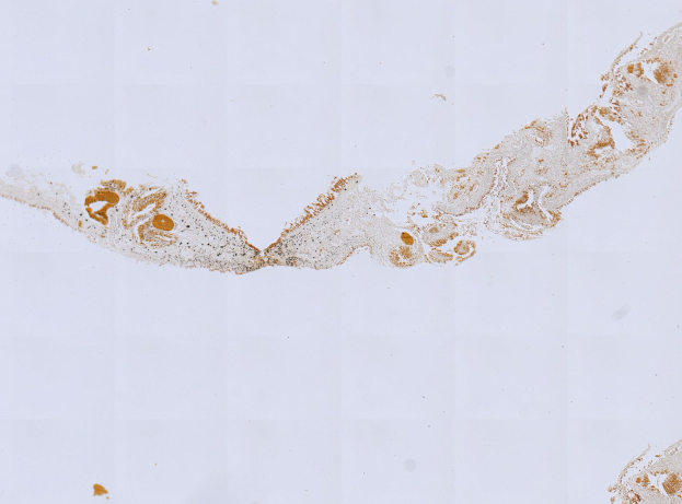 Mikroskopisches Bild einer Formalin/PFA-fixierten Paraffin-embedded Gewebeschnitt, gefärbt mit anti-PFA1-Antikörper (EPR22828) und BSA.